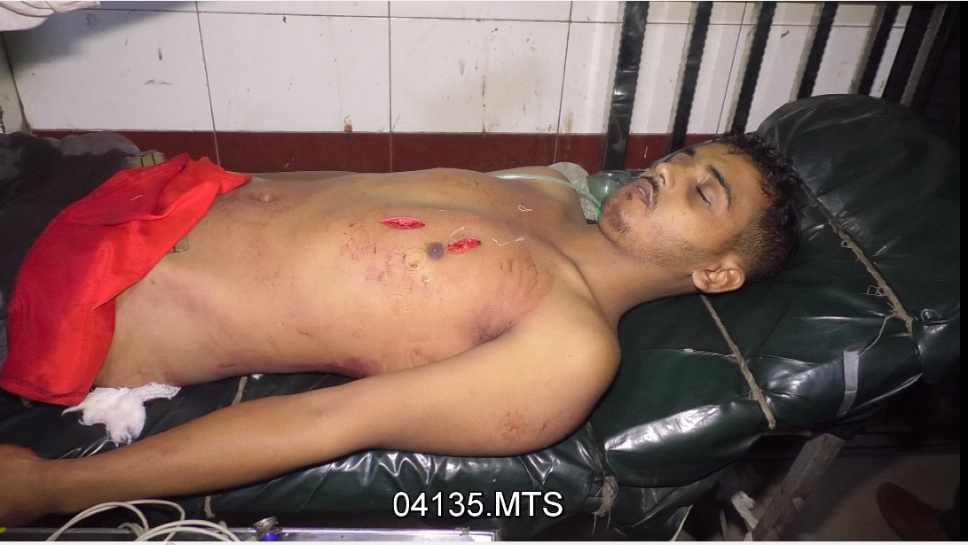 1640370696508 Brahmanbaria murder pic